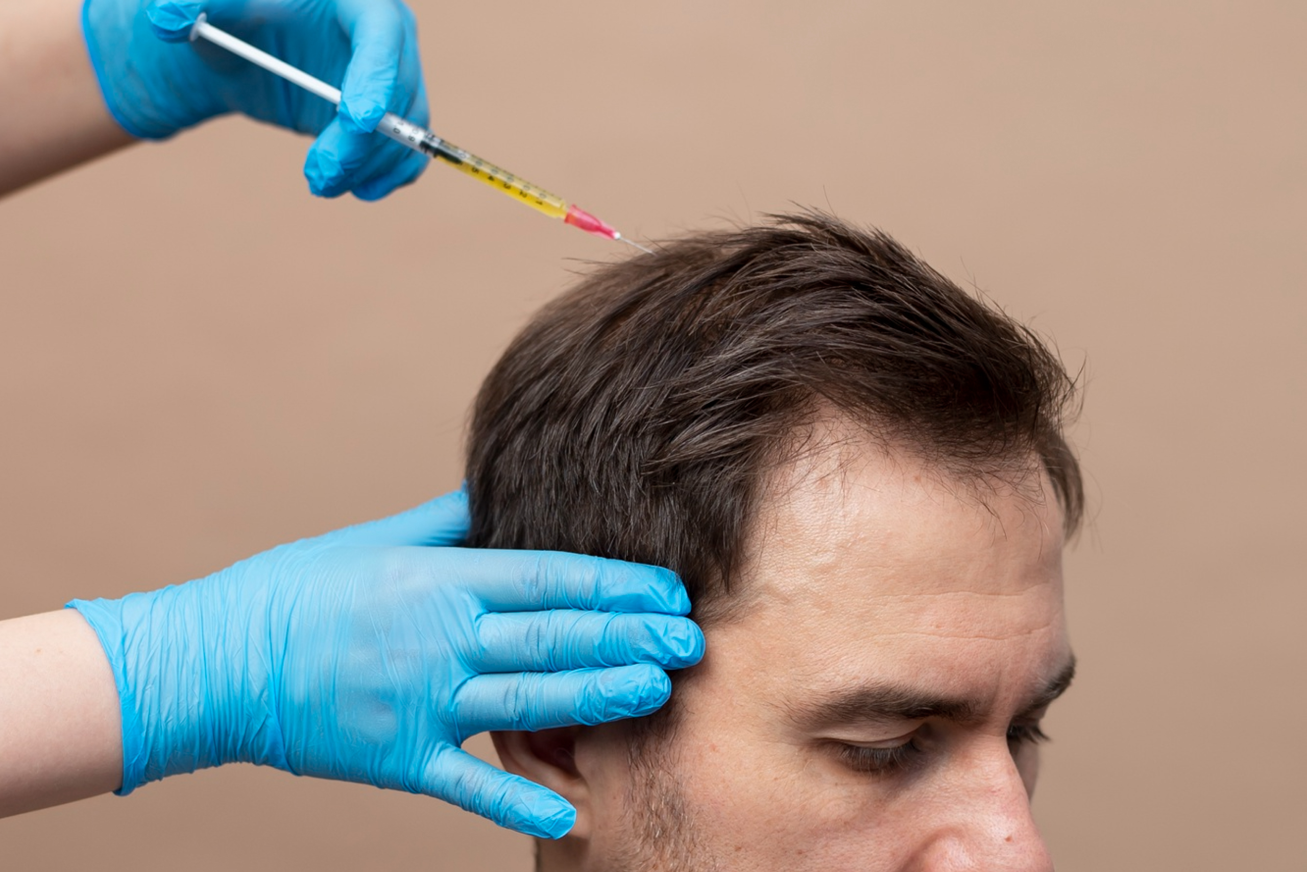 Мезотерапия для волос: как выбрать препараты